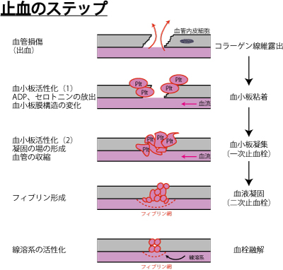 血栓、凝固因子、血小板、血行不良